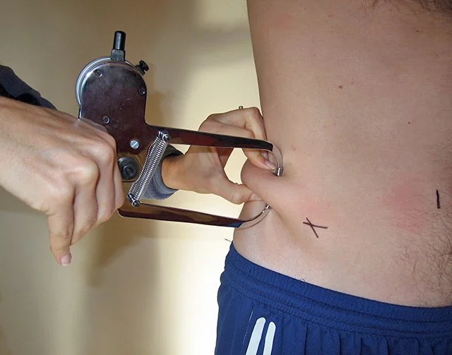 Skinfold measurement being taken